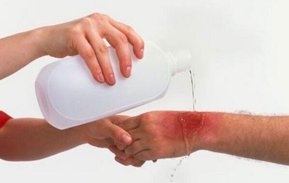 cach-xu-ly-khi-bi-sua-can-2 cach-xu-ly-khi-bi-sua-can-2